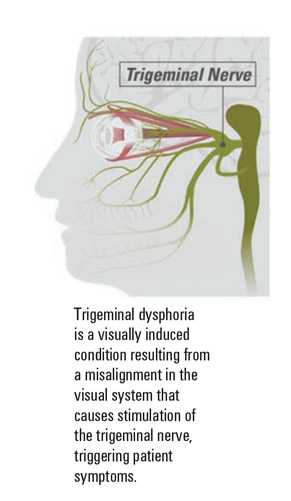 corbin simon trigeminal nerve