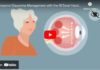 Improve Glaucoma Management with the RETeval glaucoma management video