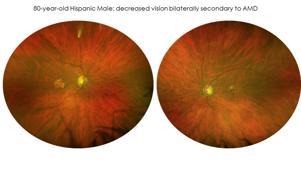 second case example of three sets of images showing different imaging with GA