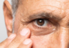 The Optometric Male Aesthetic Patient older male rubbing his eyes