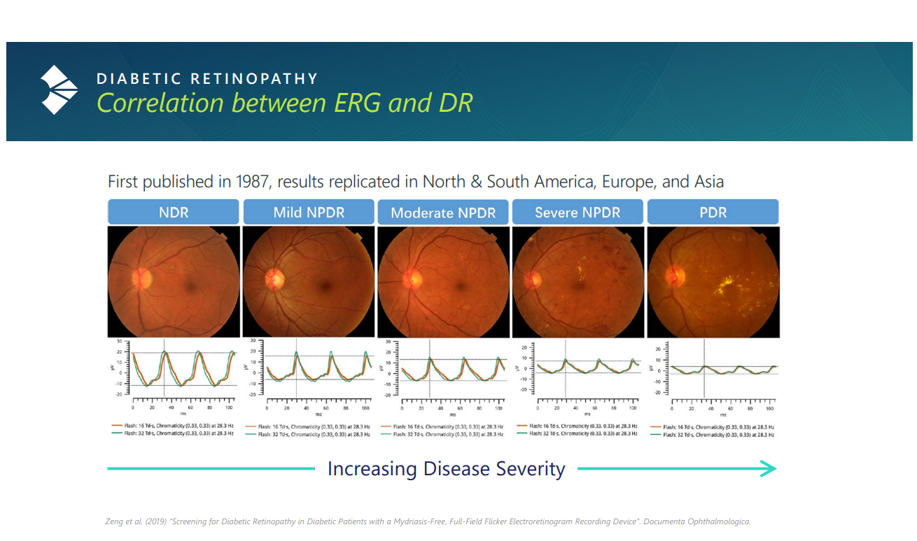 ERG corrrelation to diabetic retinopathy severity