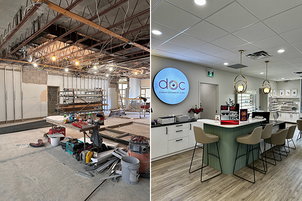 before and after optical dispensing