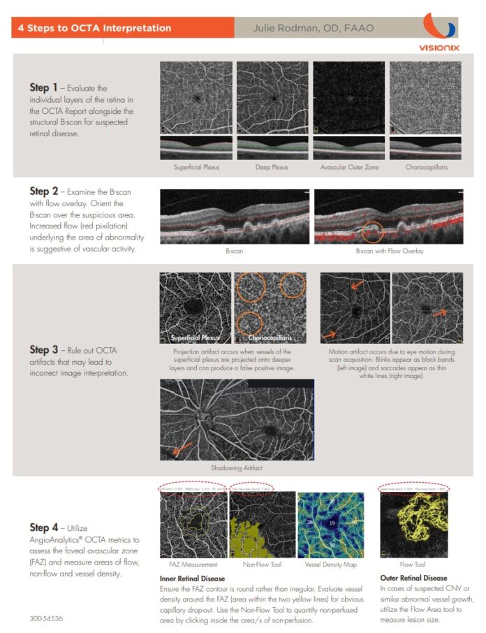 OCT-A Interpretation Quick Guide | Women In Optometry