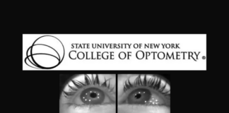 SUNY Researchers Propose Explanation on Myopia